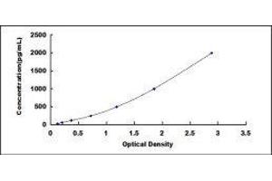 ELISA image for Procollagen II C-Terminal Propeptide (PIICP) ELISA Kit (ABIN431542) (PIICP ELISA 试剂盒)