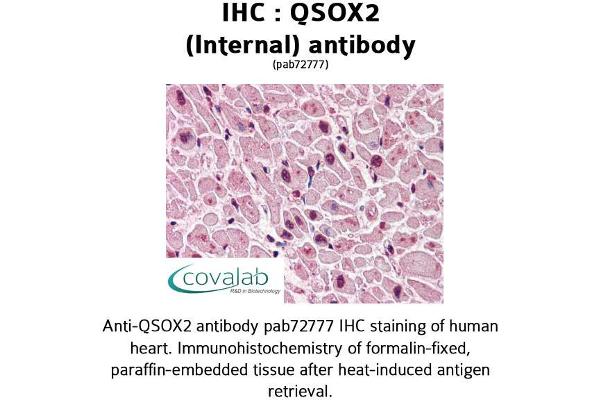 QSOX2 抗体  (Internal Region)