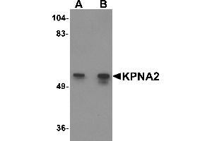 Western Blotting (WB) image for anti-Karyopherin alpha 2 (RAG Cohort 1, Importin alpha 1) (KPNA2) (N-Term) antibody (ABIN1031430) (KPNA2 抗体  (N-Term))
