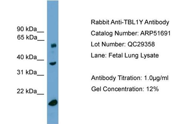 TBL1Y 抗体  (Middle Region)