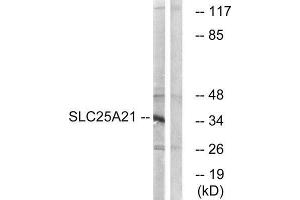 Western Blotting (WB) image for anti-Solute Carrier Family 25 (Mitochondrial Oxodicarboxylate Carrier), Member 21 (Slc25a21) (Internal Region) antibody (ABIN1851571) (SLC25A21 抗体  (Internal Region))