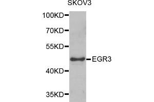 Western blot analysis of extracts of SKOV3 cells, using EGR3 antibody (ABIN5975619) at 1/1000 dilution. (EGR3 抗体)