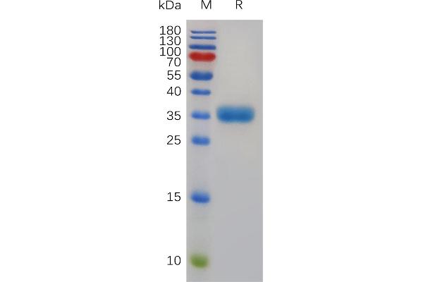 TPSAB1 Protein (AA 19-275) (His tag)