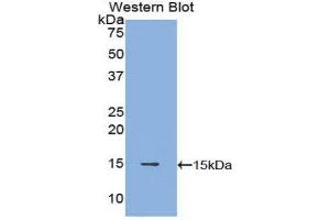Western Blotting (WB) image for anti-POTE Ankyrin Domain Family, Member J (POTEJ) (AA 109-269) antibody (ABIN1171897) (POTEJ 抗体  (AA 109-269))