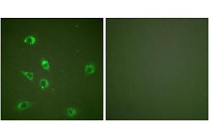 Immunofluorescence analysis of NIH/3T3 cells, using Glucagon antibody (ABIN5976409). (Glucagon 抗体  (Internal Region))