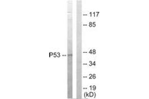 Western blot analysis of extracts from HepG2 cells, using p53 Antibody. (p53 抗体  (AA 301-350))