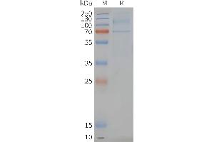 Human -Nanodisc, Flag Tag on SDS-PAGE (LGR6 蛋白)