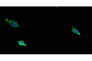 Immunofluorescent analysis of Hela cells using ABIN7177325 at dilution of 1:100 and Alexa Fluor 488-congugated AffiniPure Goat Anti-Rabbit IgG(H+L) (ITGB1 抗体  (AA 21-728))