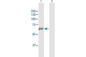 Western Blot analysis of ANTXR2 expression in transfected 293T cell line by ANTXR2 MaxPab polyclonal antibody. (ANTXR2 抗体  (AA 1-488))