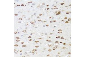 Immunohistochemistry of paraffin-embedded rat brain using ARHGAP5 antibody (ABIN1871080) at dilution of 1:100 (40x lens). (ARHGAP5 抗体)