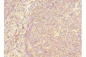 Immunohistochemistry of paraffin-embedded human tonsil tissue using ABIN7154651 at dilution of 1:100 (MCF2L 抗体  (AA 850-980))