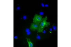 Anti-PKLR mouse monoclonal antibody (ABIN2453474) immunofluorescent staining of COS7 cells transiently transfected by pCMV6-ENTRY PKLR (RC206455). (PKLR 抗体)