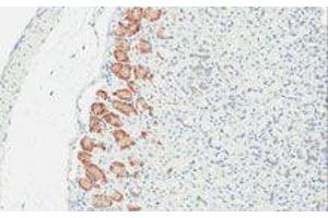 Immunohistochemistry (IHC) image for anti-TLR4 /MD2 Complex antibody (ABIN2665420) (TLR4 /MD2 Complex 抗体)