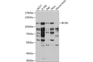 Western blot analysis of extracts of various cell lines, using BCAN antibody  at 1:3000 dilution. (BCAN 抗体  (AA 762-911))