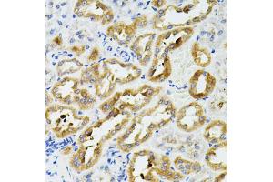 Immunohistochemistry of paraffin-embedded rat kidney using SIRT3 antibody. (SIRT3 抗体)