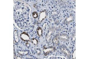 ABIN6266549 at 1/100 staining human kidney tissue sections by IHC-P. (GRIK1 抗体  (Internal Region))