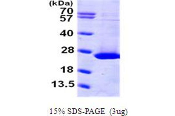 ARL1 Protein (AA 1-181) (His tag)