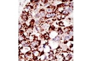 Image no. 2 for anti-GPI-anchor transamidase (GPI8) (C-Term) antibody (ABIN357726) (PIGK 抗体  (C-Term))