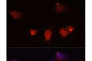 Immunofluorescence analysis of U-251MG cells using NPY Polyclonal Antibody at dilution of 1:100 (40x lens). (NPY 抗体)