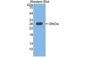 Western Blotting (WB) image for anti-Ubiquitin Carboxyl-terminal Esterase L1 (Ubiquitin Thiolesterase) (UCHL1) (AA 2-223) antibody (ABIN1078638) (UCHL1 抗体  (AA 2-223))