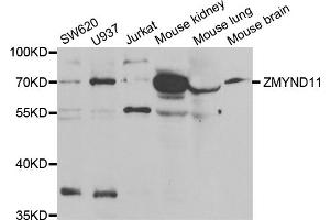 Western blot analysis of extracts of various cell lines, using ZMYND11 antibody (ABIN5973742) at 1/1000 dilution. (ZMYND11 抗体)