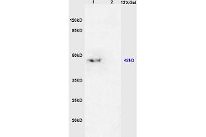 L1 mouse brain lysates, L2 mouse kidney lysates probed with Anti- TGF beta 2 Propeptide Polyclonal Antibody, Unconjugated (ABIN724880) at 1:200 in 4 °C. (TGF beta 2 Propeptide (AA 154-197) 抗体)