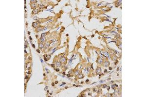 Immunohistochemistry (IHC) image for anti-Histone 3 (H3) (H3K27me) antibody (ABIN3023269)