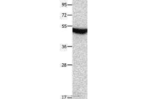 Western blot analysis of Mouse brain tissue, using MTNR1A Polyclonal Antibody at dilution of 1:650 (Melatonin Receptor 1A 抗体)