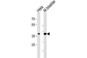 Western Blotting (WB) image for anti-Eukaryotic Translation Initiation Factor 3 Subunit H (EIF3H) antibody (ABIN3002723) (EIF3H 抗体)