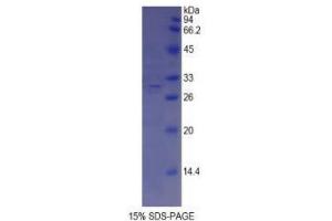 SDS-PAGE analysis of Mouse ABCA1 Protein. (ABCA1 蛋白)