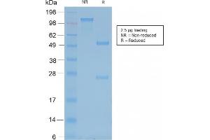 SDS-PAGE (SDS) image for anti-Neurofilament, Heavy Polypeptide (NEFH) antibody (ABIN6940185)