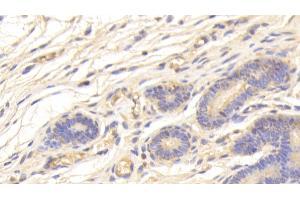 Detection of SPINK5 in Human Uterus Tissue using Polyclonal Antibody to Serine Peptidase Inhibitor Kazal Type 5 (SPINK5) (SPINK5 抗体  (AA 699-976))