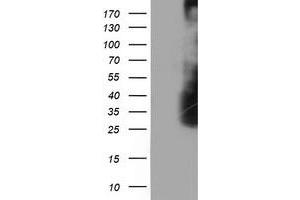 HEK293T cells were transfected with the pCMV6-ENTRY control (Left lane) or pCMV6-ENTRY LDLRAP1 (Right lane) cDNA for 48 hrs and lysed. (LDLRAP1 抗体)