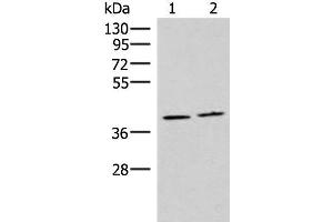 Western blot analysis of Human placenta tissue and Human fetal brain tissue lysates using HMGCLL1 Polyclonal Antibody at dilution of 1:1000 (HMGCLL1 抗体)