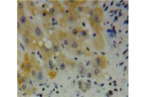 Used in DAB staining on fromalin fixed paraffin-embedded Liver tissue (Desmin 抗体  (AA 117-348))