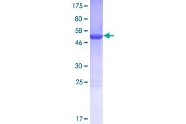 PDCL2 Protein (AA 1-241) (GST tag)