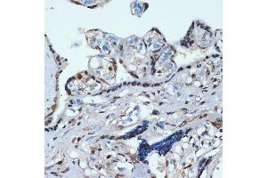 Immunohistochemistry of paraffin-embedded human placenta using HOX Rabbit mAb (ABIN7267764) at dilution of 1:100 (40x lens). (HOXA9 抗体)