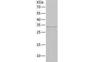 HSD17B14 Protein (AA 1-306) (His tag)