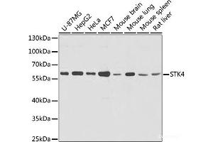 Western blot analysis of extracts of various cells using STK4 Polyclonal Antibody at dilution of 1:1000. (STK4 抗体)