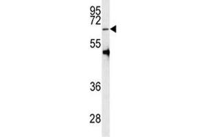 Western blot analysis of PRMT5 antibody and HL-60 lysate (PRMT5 抗体  (AA 473-499))