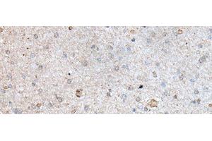 Immunohistochemistry of paraffin-embedded Human brain tissue using RAB4A Polyclonal Antibody at dilution of 1:40(x200) (Rab4 抗体)
