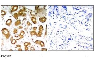 Image no. 1 for anti-Nuclear Factor-kB p65 (NFkBP65) (Thr505) antibody (ABIN319322) (NF-kB p65 抗体  (Thr505))