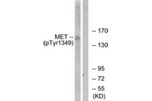 Western Blotting (WB) image for anti-Met Proto-Oncogene (MET) (pTyr1349) antibody (ABIN2888473) (c-MET 抗体  (pTyr1349))