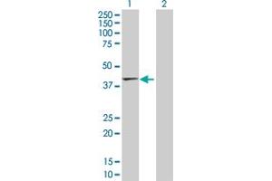 Western Blot analysis of TMOD2 expression in transfected 293T cell line by TMOD2 MaxPab polyclonal antibody. (TMOD2 抗体  (AA 1-351))