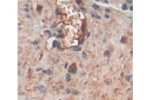 IHC-P analysis of Rat Tissue, with DAB staining. (COMP 抗体  (AA 235-423))