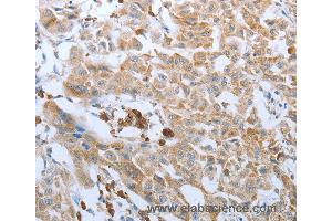 Immunohistochemistry of Human brain using FGF1 Polyclonal Antibody at dilution of 1:50 (FGF1 抗体)