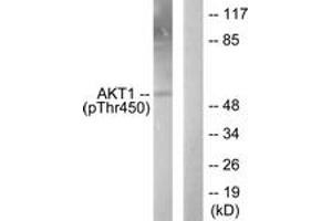 Western blot analysis of extracts from NIH-3T3 cells treated with PDGF 50ng/ml 20', using Akt1 (Phospho-Thr450) Antibody. (AKT1 抗体  (pThr450))
