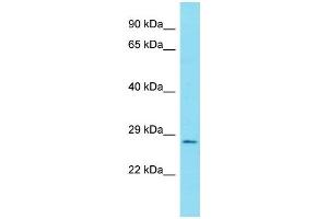 Host:  Rabbit  Target Name:  RELA  Sample Type:  Uterus Tumor lysate  Antibody Dilution:  1. (NF-kB p65 抗体  (N-Term))