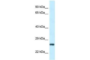 Western Blot showing RPS9 antibody used at a concentration of 1 ug/ml against Hela Cell Lysate (RPS9 抗体  (N-Term))