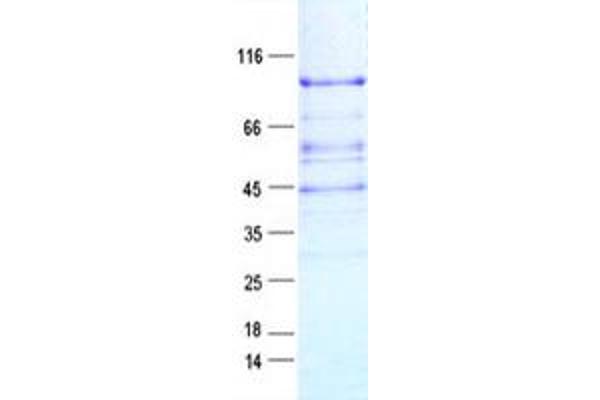 APLF Protein (DYKDDDDK Tag)